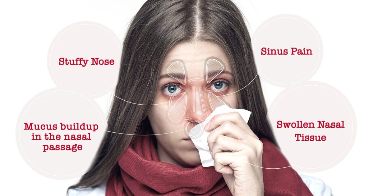 Home Treatments For Nasal Congestion And Sinus Pressure Westside Head 