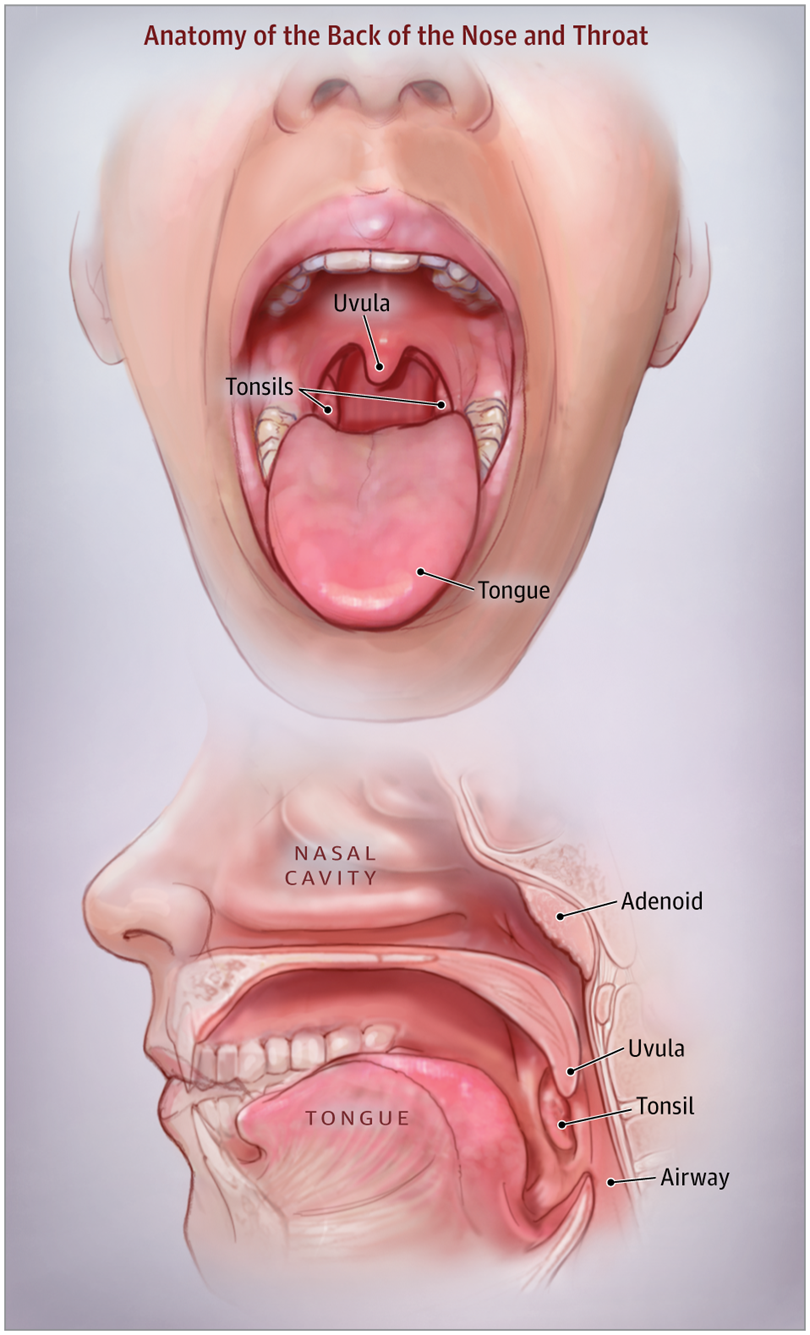 adenoidectomy-adenoid-removal-westside-head-neck